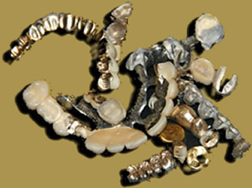 Zahngold, Goldankauf PLUS,  Frankfurt am Main